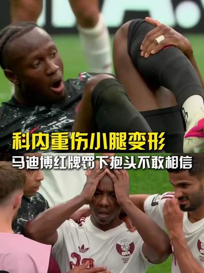 小腿恐怖变形之痛后重生？加拿大锋线悍将引爆中超转会市场